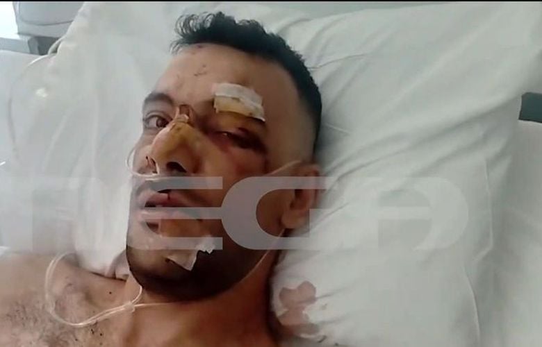 Προφυλακίστηκε ο 32χρονος για την επίθεση με μαχαίρι σε 35χρονο σε πανηγύρι της Μυτιλήνης