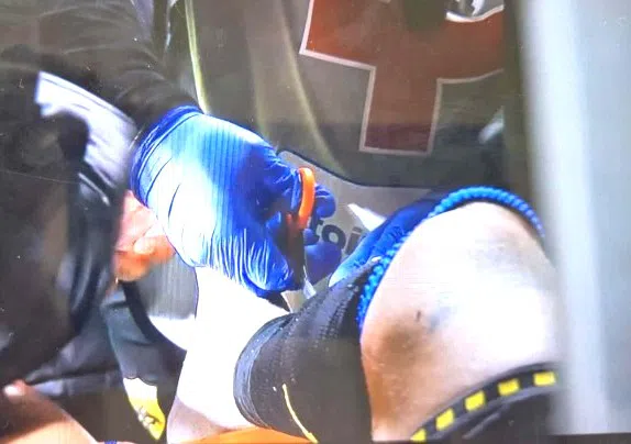 Ανατριχιαστική στιγμή: Οταν οι γιατροί αναγκάστηκαν να του κόψουν την κάλτσα