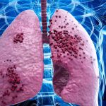 Το ιατρείο φυματίωσης της πνευμονολογικής κλινικής του νοσοκομείου Παπανικολάου