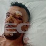 Προφυλακίστηκε ο 32χρονος για την επίθεση με μαχαίρι σε 35χρονο σε πανηγύρι της Μυτιλήνης