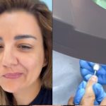 Τέρμα το ημιμόνιμο μανικιούρ για την Ελίνα Παπίλα – «Έπαθα χημικό έγκαυμα στα νύχια», λέει η ίδια στο TikTok