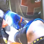 Ανατριχιαστική στιγμή: Οταν οι γιατροί αναγκάστηκαν να του κόψουν την κάλτσα