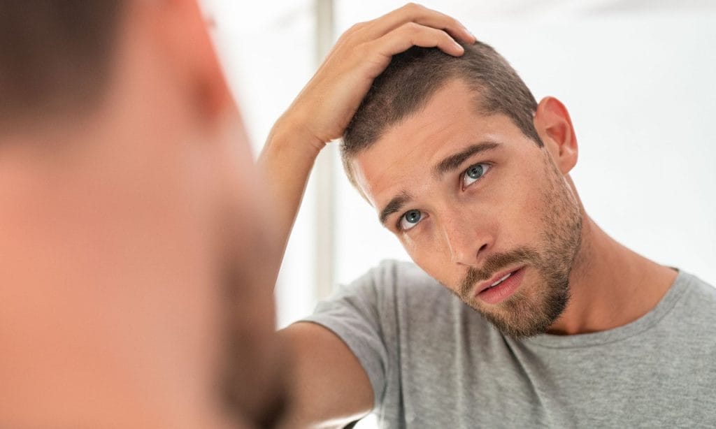 Τριχόπτωση: Ποιος συγγενής «ευθύνεται» για τη φαλάκρα; (Και δεν είναι ο πατέρας σας!)