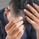 Τριχόπτωση: Ποιος συγγενής «ευθύνεται» για τη φαλάκρα; (Και δεν είναι ο πατέρας σας!)