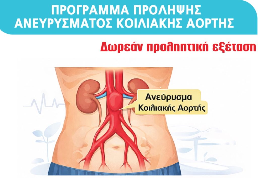 Δήμος Καλαμαριάς: Δωρεάν προληπτικοί έλεγχοι για ανεύρυσμα κοιλιακής αορτής